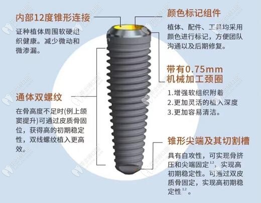 瑞典诺贝尔PMC种植牙