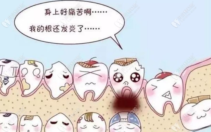 怎么判断干槽症