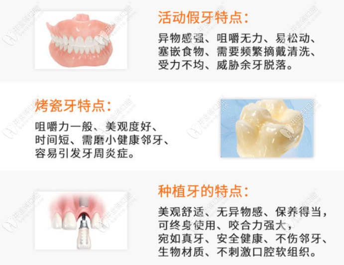 活动假牙、烤瓷牙、种植牙的对比以及各修复方式的特点