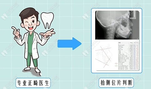 正畸医生通过拍片来测量判断