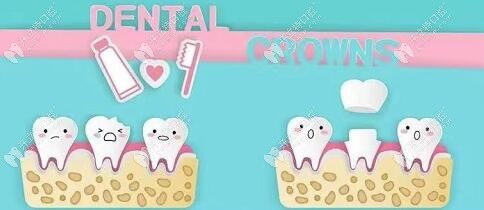 榆林市好的牙科排行榜已发布,这有榆林牙齿矫正较好的医院