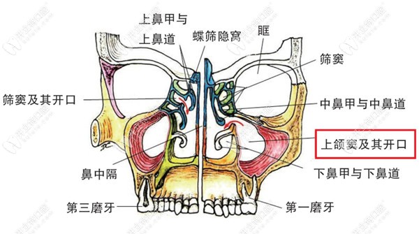 种植牙上颌窦的位置