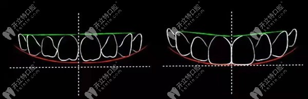 dsd数字微笑设计图片