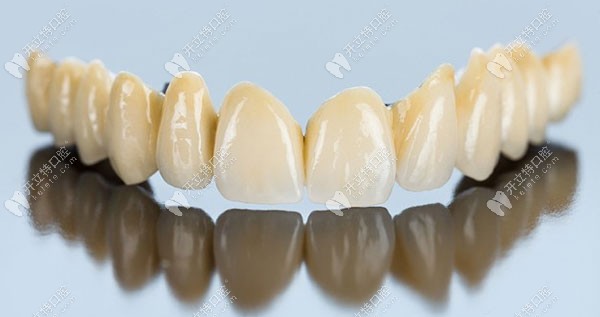 阿曼吉爾巴赫全瓷牙的優(yōu)點(diǎn)