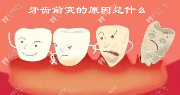 整牙前须知:上排牙齿前突的原因及怎么矫正