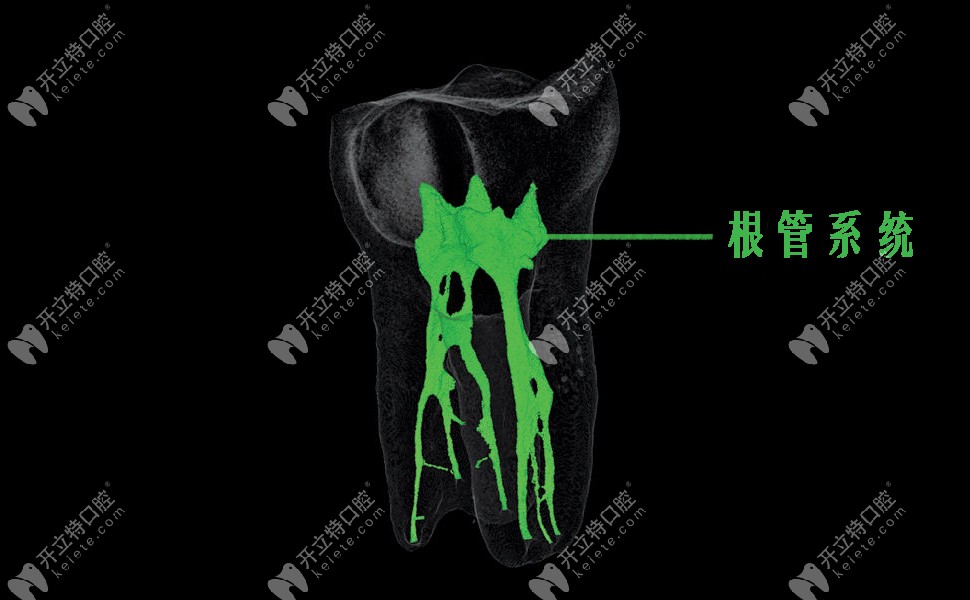 牙齿根管系统