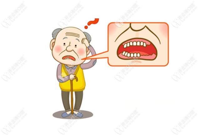老年人做半口假牙哪种经济实惠?吸附性义齿/all-on-4种植牙都.