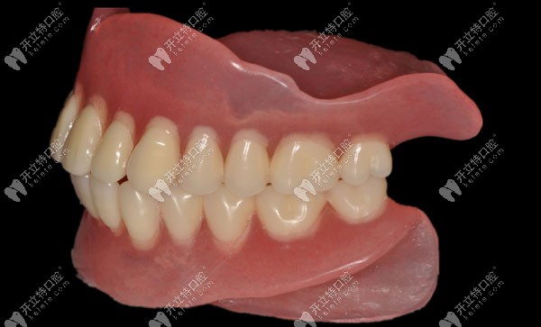 看覆盖性和吸附性义齿的区别同是活动义齿但固定方法不同