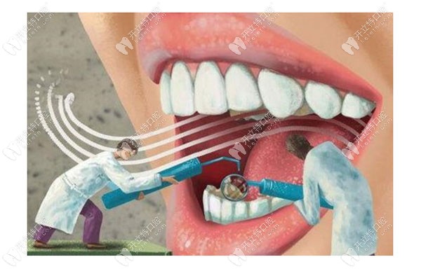 戴牙套什么感觉表示牙齿移动
