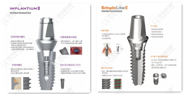 韩国登腾种植体各型号的特点