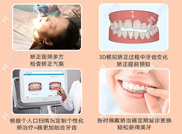 成都医大口腔牙齿矫正流程