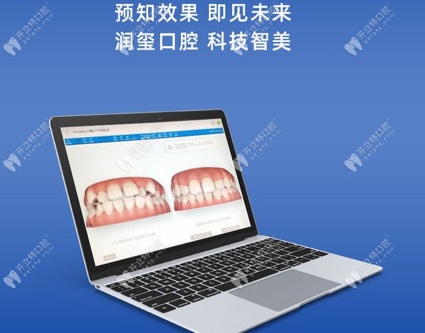 南京润玺口腔的牙齿矫正项目