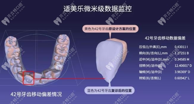 适美乐微米级数据监控