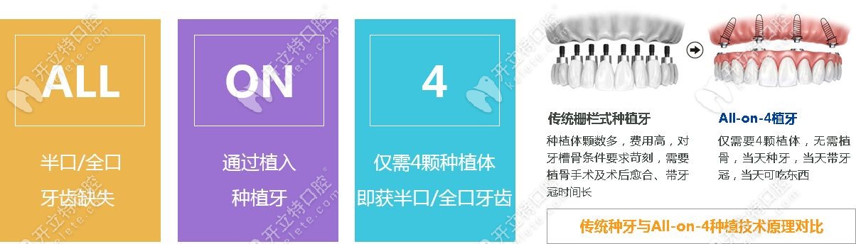 all-on-4半口種植牙