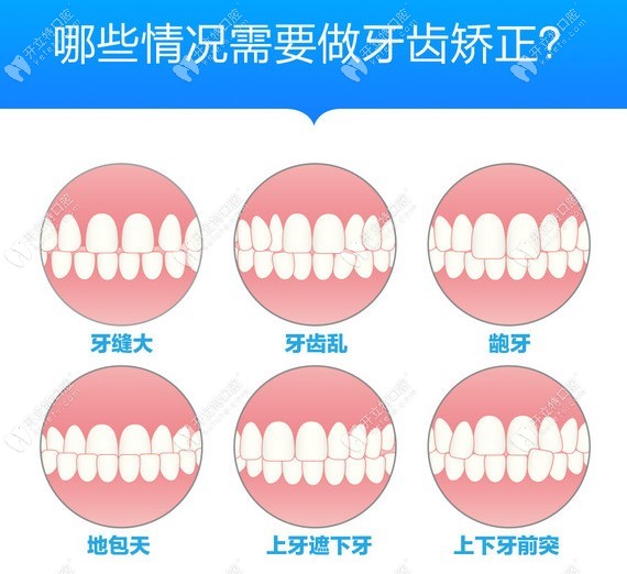 北京万柳优合诊所牙齿矫正