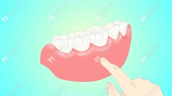 牙龈增生发生的位置