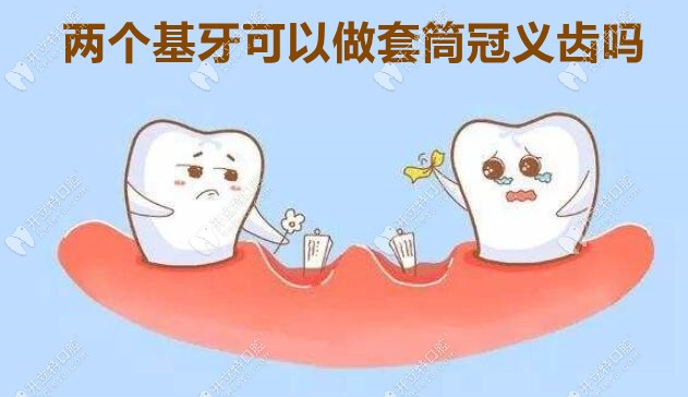 两个基牙可以做套筒冠义齿吗？了解其适应症及优缺点便知