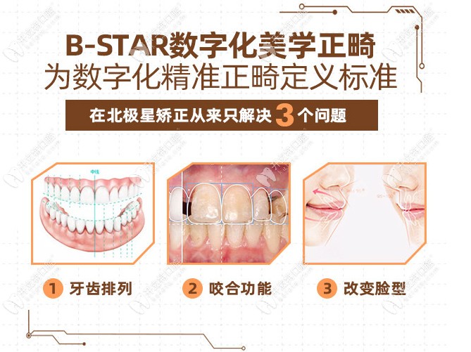 北极星口腔的数字化美学正畸