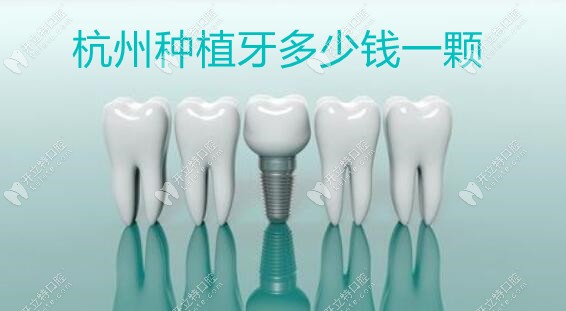 2022杭州种植牙齿多少钱一颗?即刻种植牙4000元能搞定吗