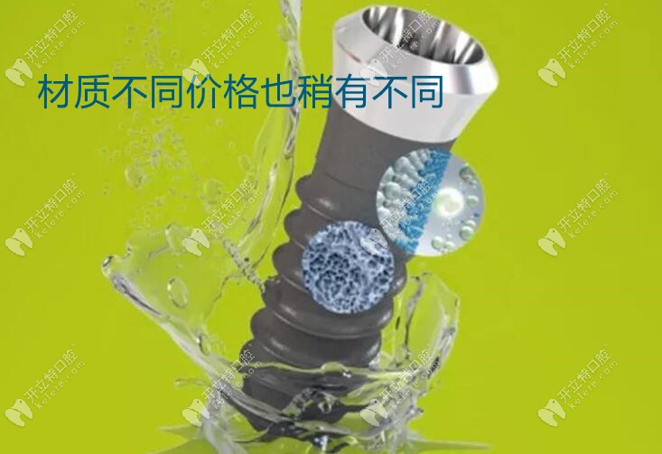 材質(zhì)不同價(jià)格也稍有不同