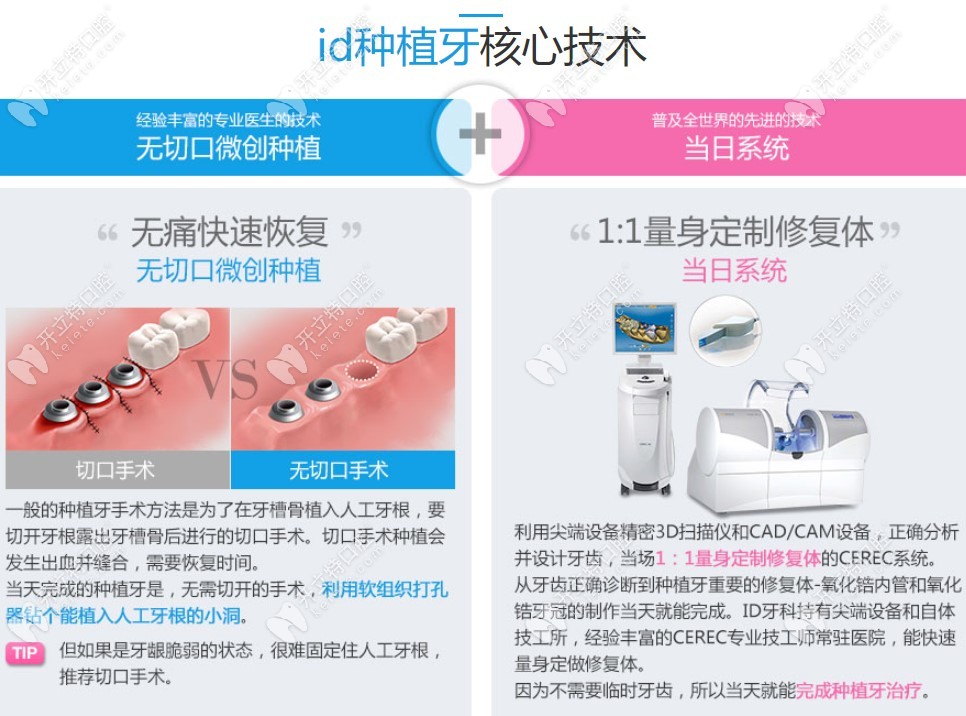 韩国id医院的种植牙核心技术
