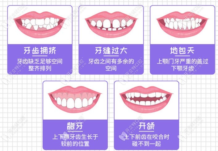 适合做牙齿矫正的牙齿类型