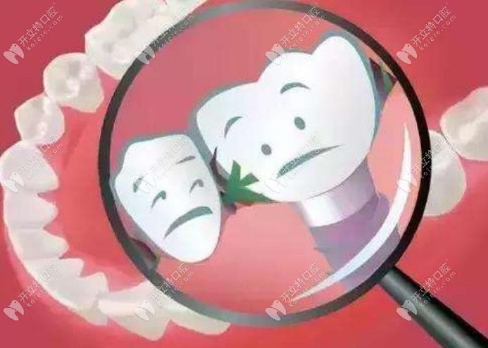 种植牙和自己牙齿之间的菌斑