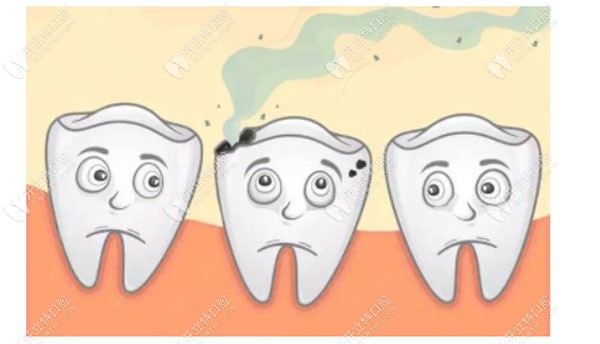 美国3M树脂补牙和德国树脂补牙的区别