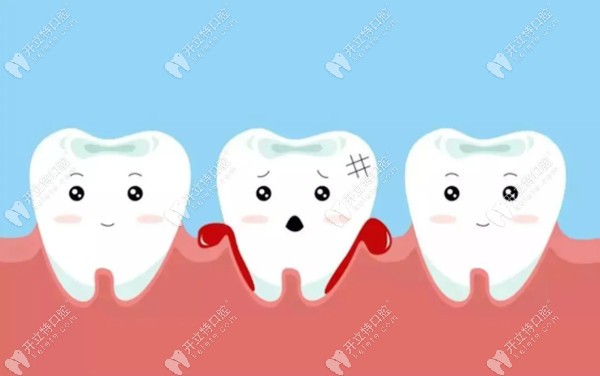 如何应对牙龈出血红肿