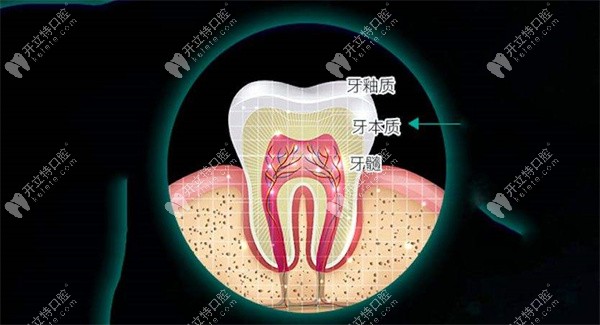 牙贴面拆除对牙有影响吗