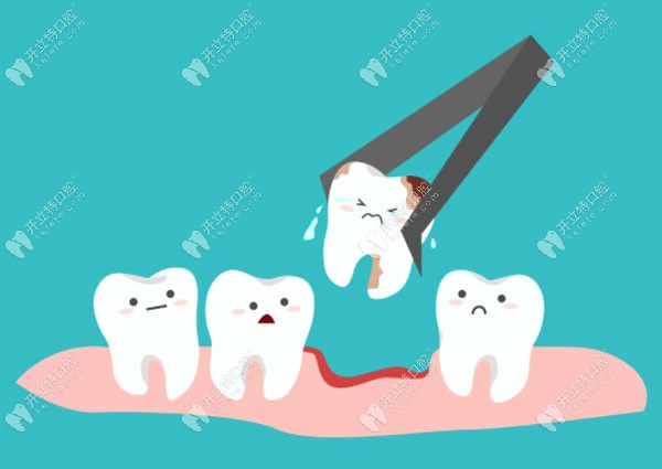 拔牙矫正通常拔哪些牙