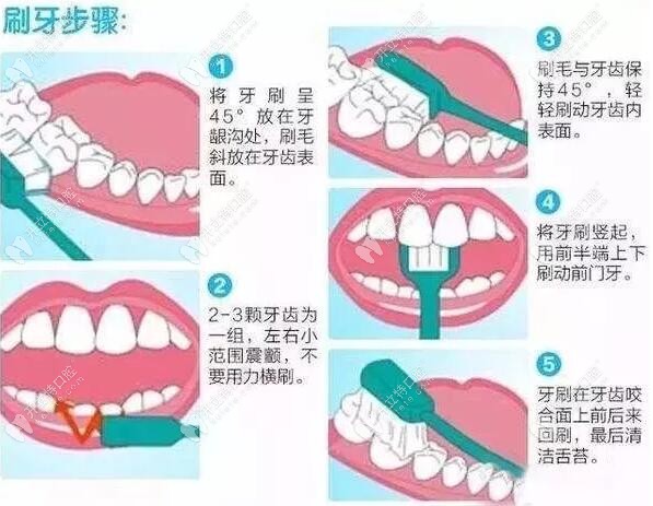 电动牙刷的使用方法