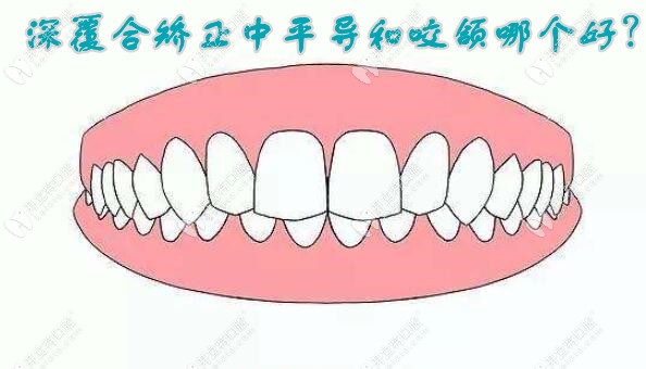 牙齿深覆合用平导和颌垫哪种好？颌垫和平导作用上有区别