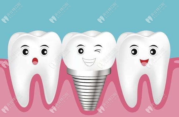 绵阳哪家牙科做种植牙技术好?若种5颗美国皓圣植体多少钱