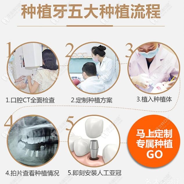 深圳宝城口腔种植牙流程