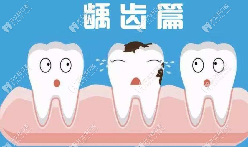 成人能做窝沟封闭和涂氟吗?成人预防蛀牙的措施有哪些