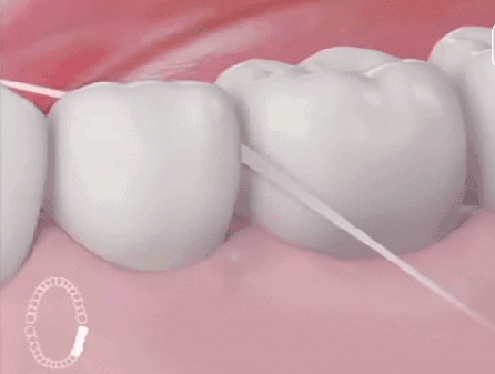 微蜡牙线和普通牙线有什么区别,新手建议用含蜡牙线哟