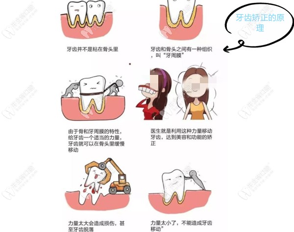 牙齿矫正的卡通图片