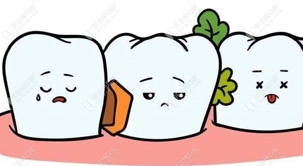 牙缝大容易引起食物嵌塞