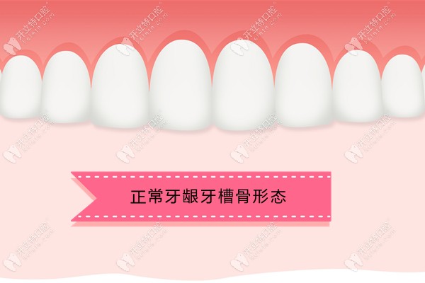 正常牙龈牙槽骨形态