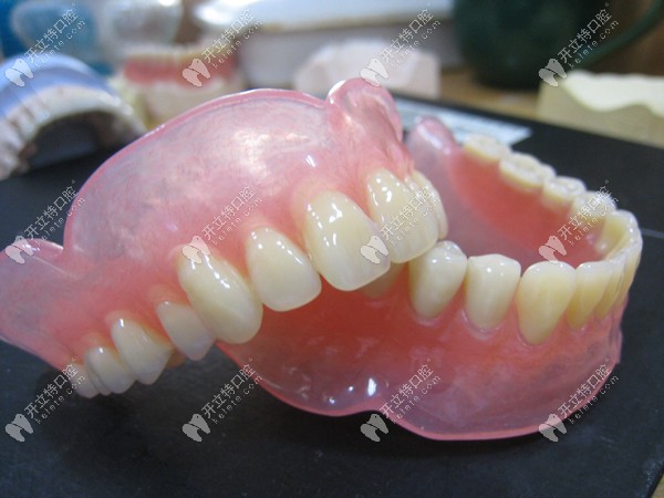 BPS生物吸附性活动义齿