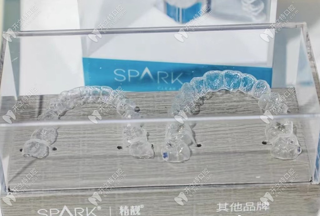 spark透明牙套和其他隐形牙套对比