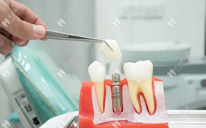 解答贫血可以种牙吗,需区分是轻度、中度还是重度贫血哦
