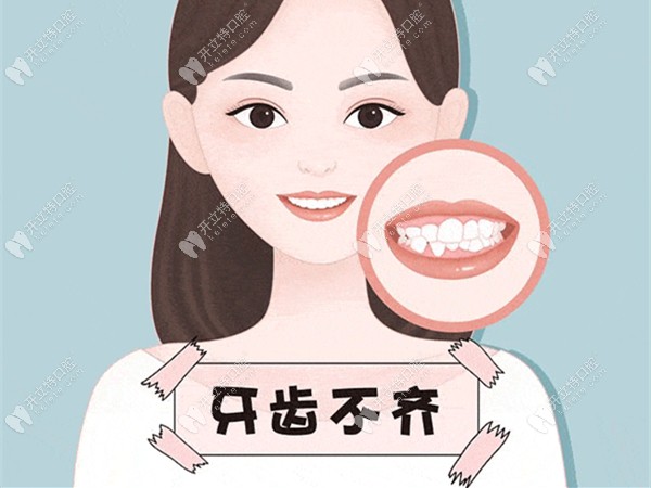 牙齿矫正的流程及步骤