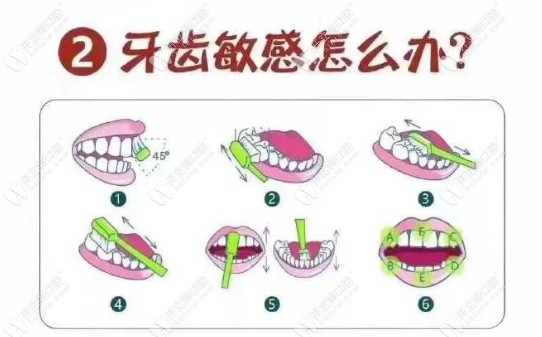 牙齿敏感怎么办