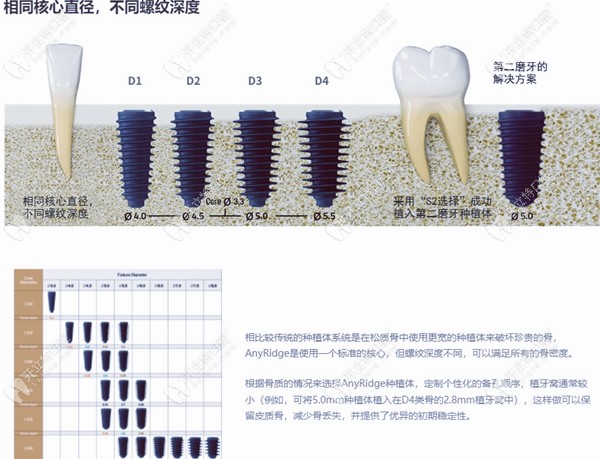 AnyRidge不同螺纹深度的对比图