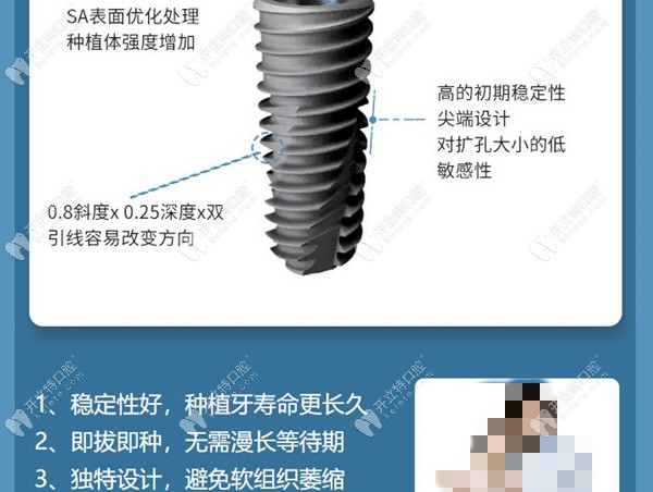 美国皓圣种植牙的优势图