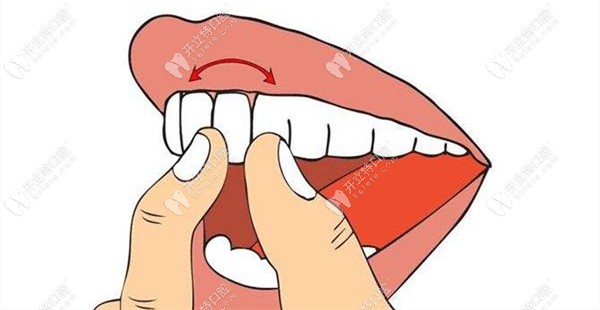 牙震荡的治疗方法