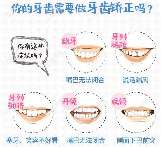 思明區(qū)美潔口腔的牙齒矯正價格