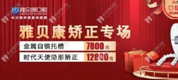 金属自锁托槽优惠价7800元起